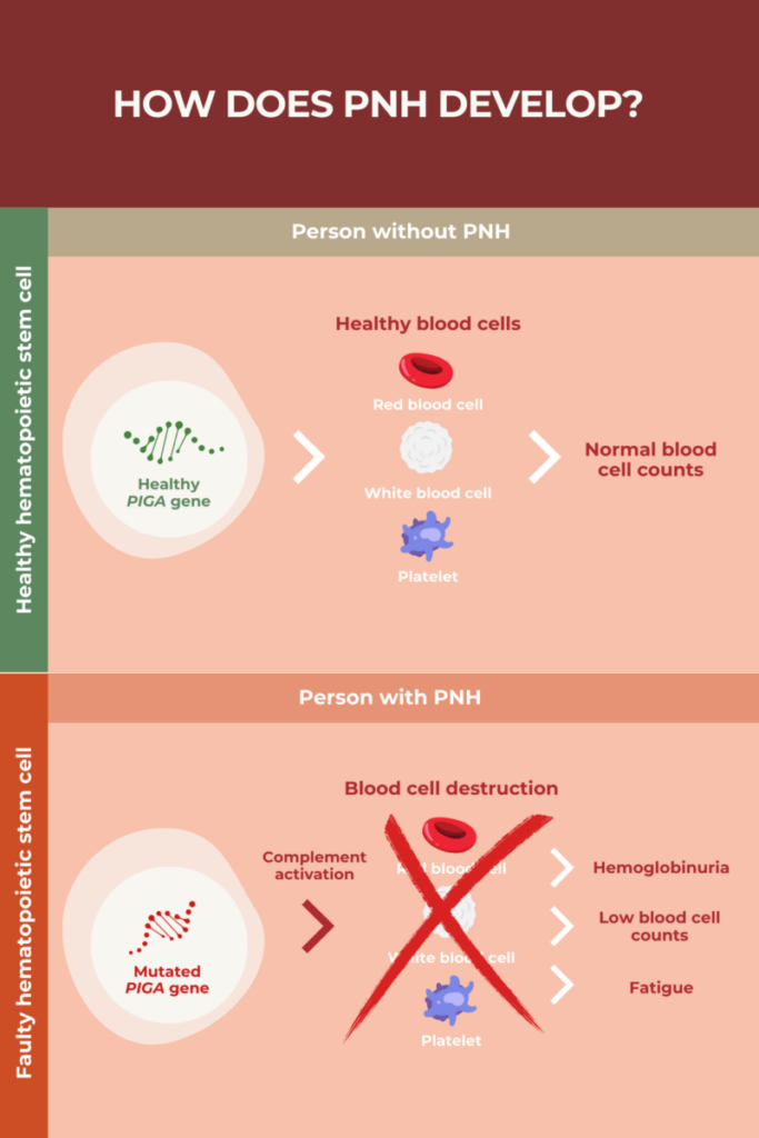 Infographic showing how PNH develops