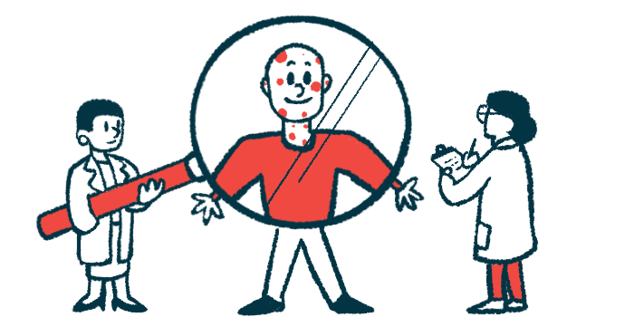 A man with spots on his face stands behind a giant magnifying glass held by two people in white coats.