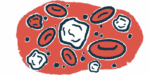 An illustration shows a close-up view of red and white blood cells.
